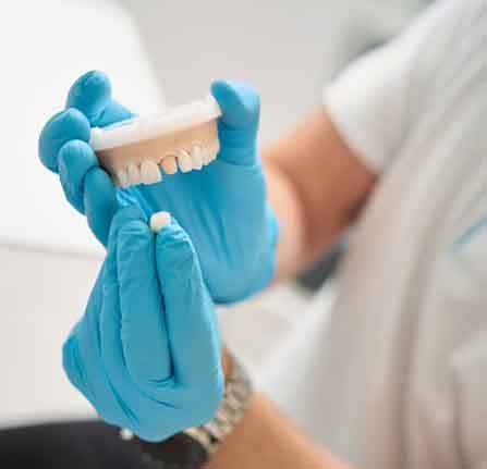 Dentist removing a dental crown from a plaster model