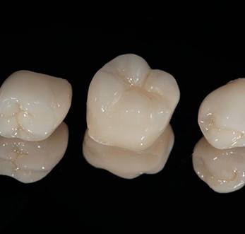 Dental crowns