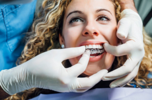 Close up of dentist fitting a patient’s Invisalign tray to her teeth