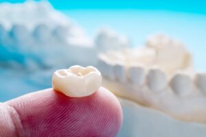 5 Signs That Your Dental Crown Needs Replacing